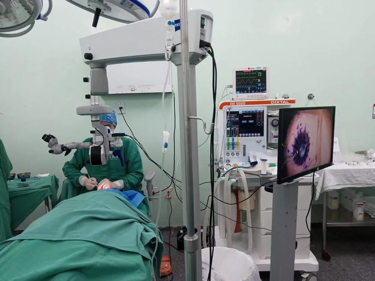transplante-cornea-hu.png